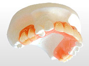 ミラクル義歯